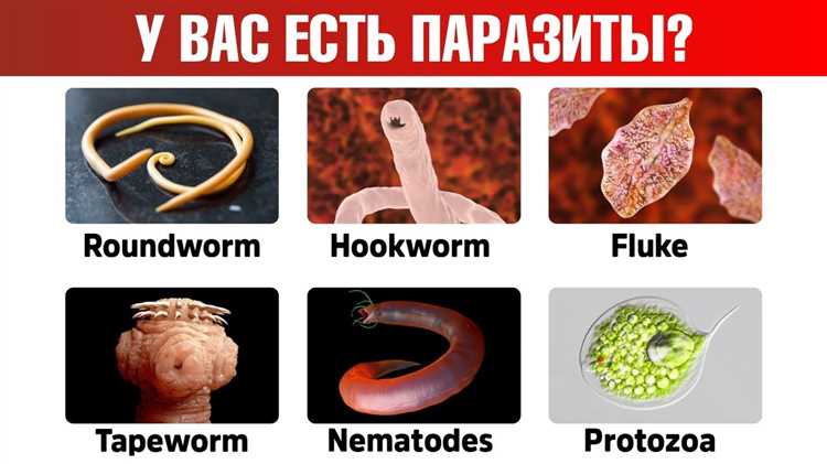 Симптомы паразитарных инфекций