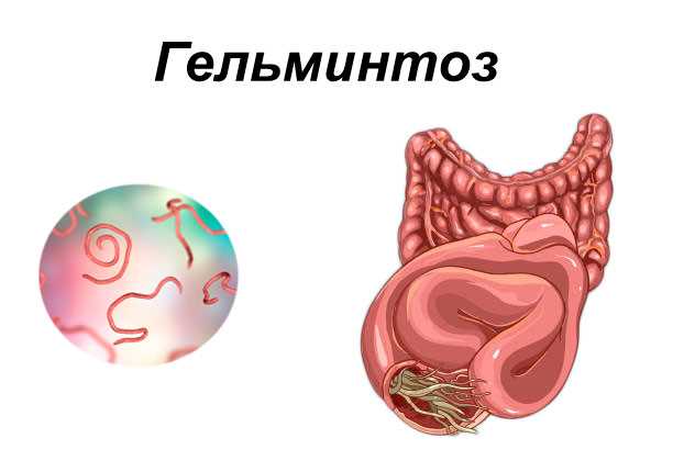 Желудочно-кишечный тракт