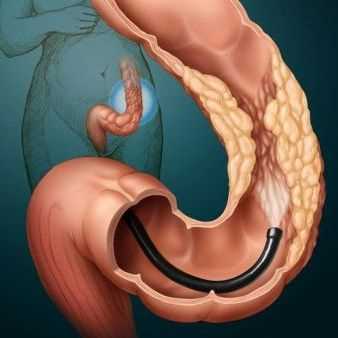 Методы проверки кишечника через задний проход