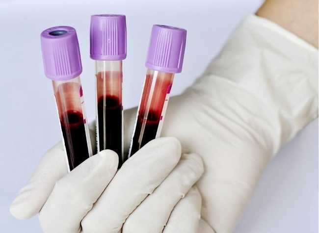 Как правильно называется анализ крови на описторхоз?