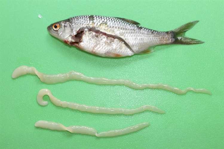 Солантоидоз - инфекционное заболевание, вызываемое употреблением сырой или некачественно обжаренной рыбы